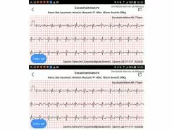 Newgen Medicals Uhr Mit EKG:Fitness-Armband, Blutdruck-& Herzfrequenz-Anzeige (Versandrückläufer) -Sitzmöbel Verkaufsgeschäft nx4393 22
